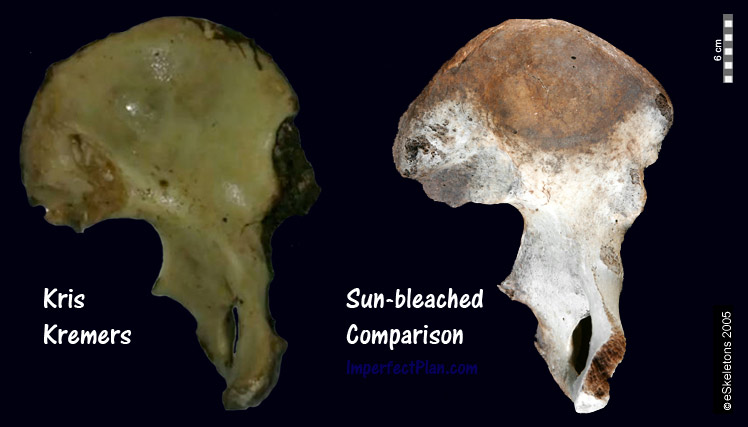 Kris Kremers Bone Comparison